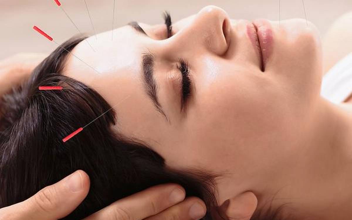 طب سوزنی بهترین روش در طب سنتی و جوانسازی پوست طب سوزنی بهترین روش در طب سنتی و جوانسازی پوست